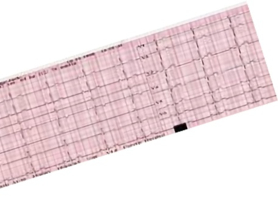 ECG - Paper - Cardio Express Z-Fold